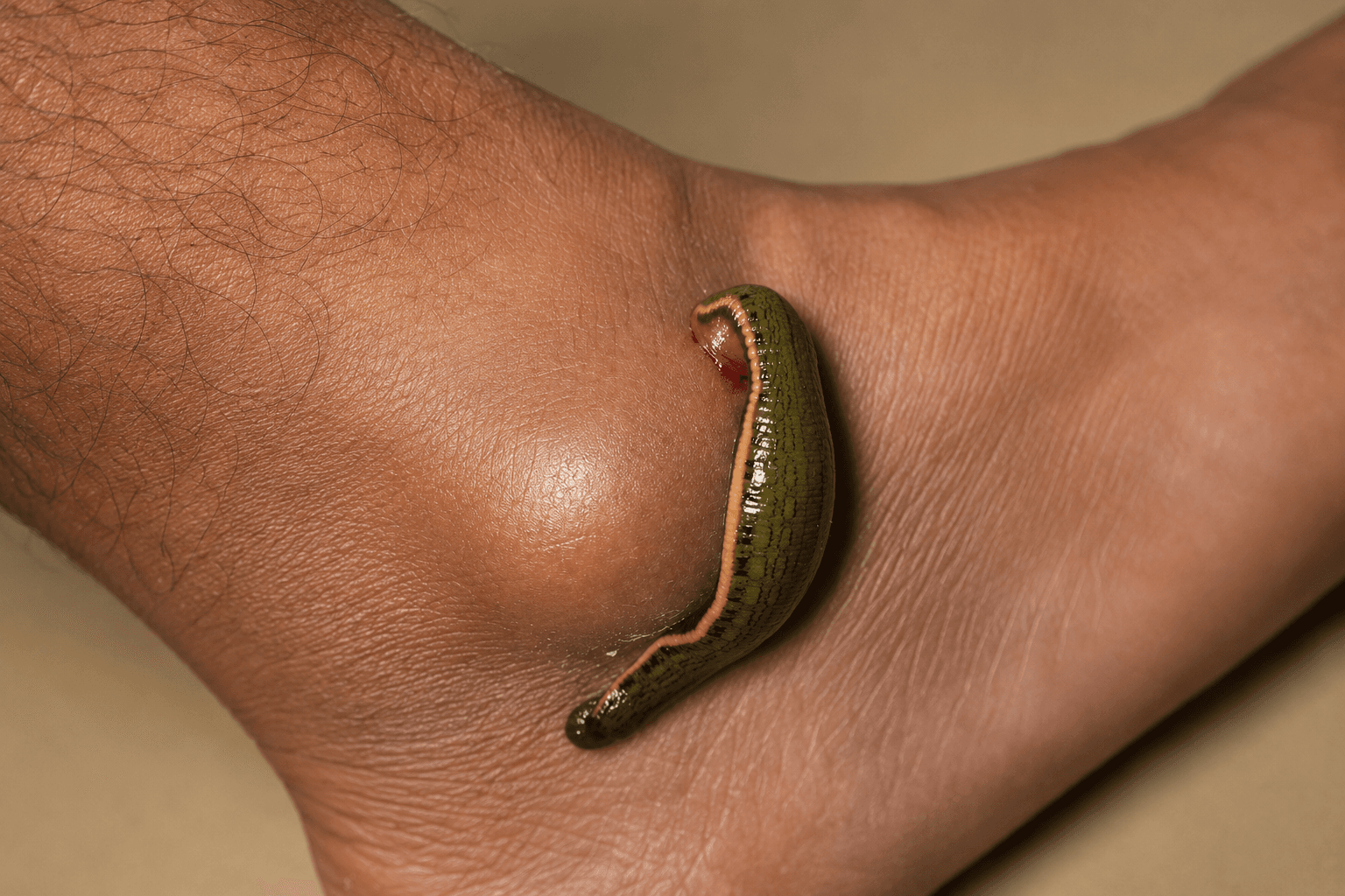 Jalaukavacharana treatment visual 3